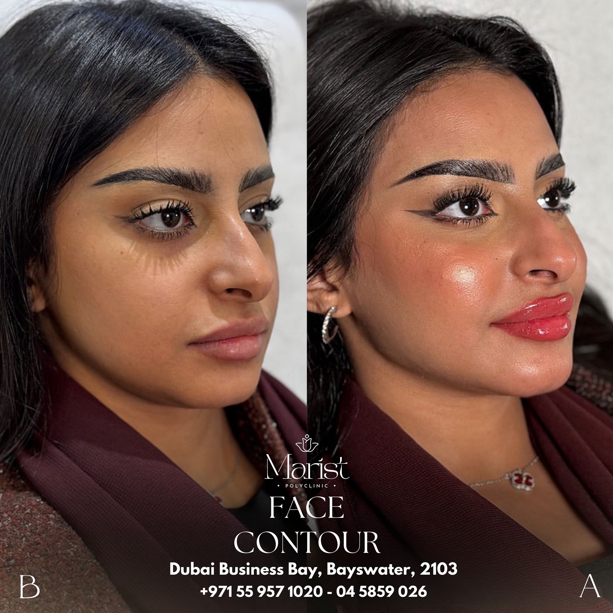 Face Contouring — Jawline & Cheek Definition