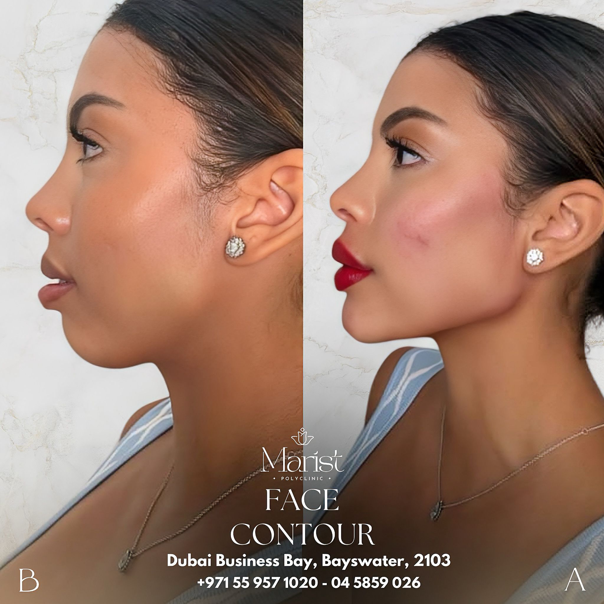 Face Contouring — Profile Enhancement