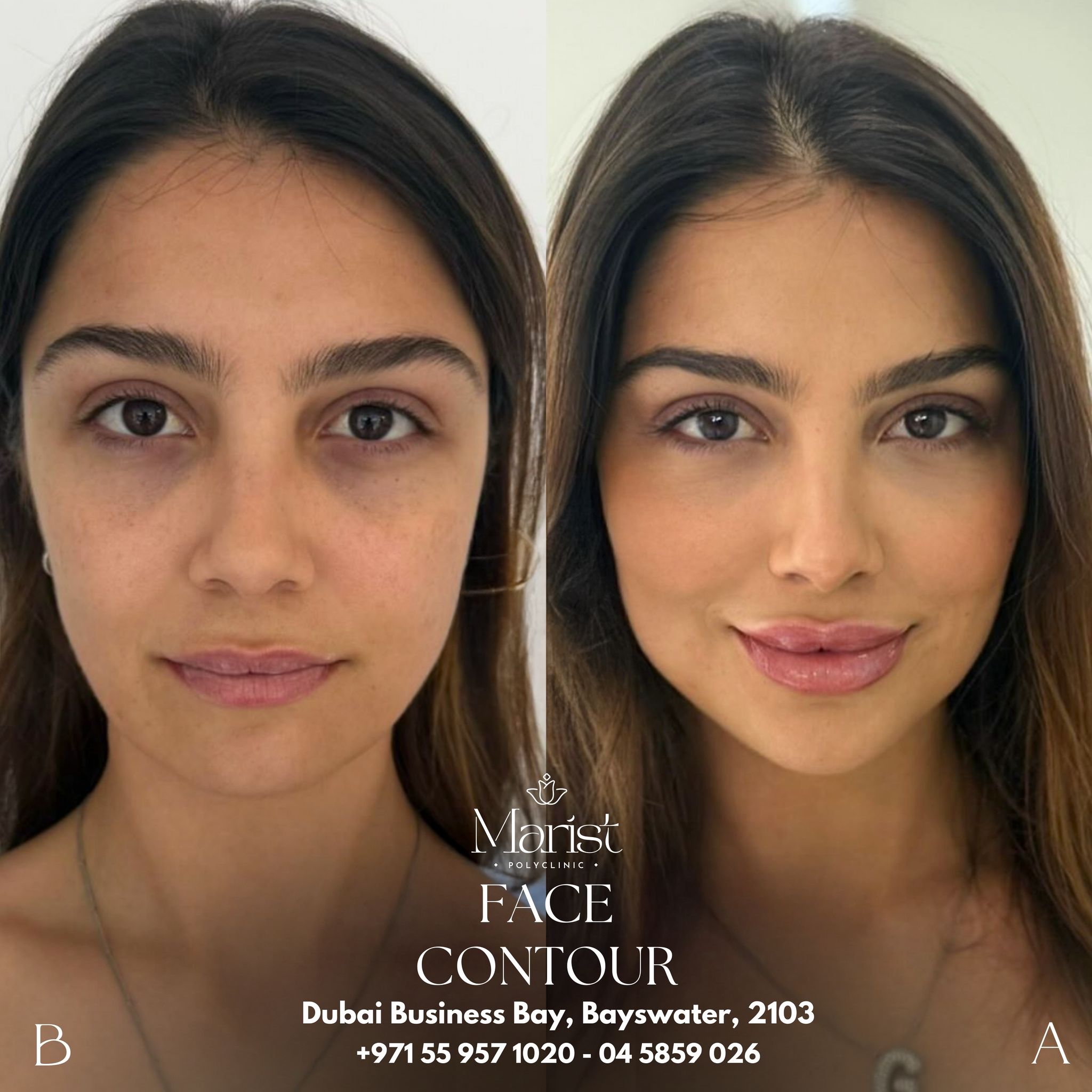 Full Face Rejuvenation — Anti-Ageing